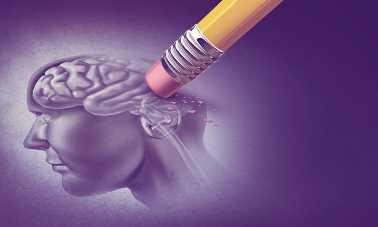 When Memories Start to Fade: Understanding Alzheimer’s