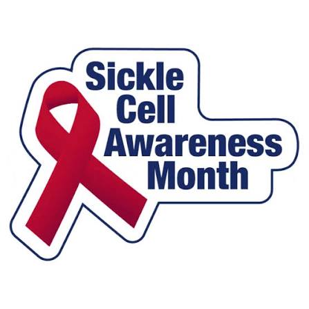 Sickle Cell Disease: When Red Blood Cells Take a Different Shape