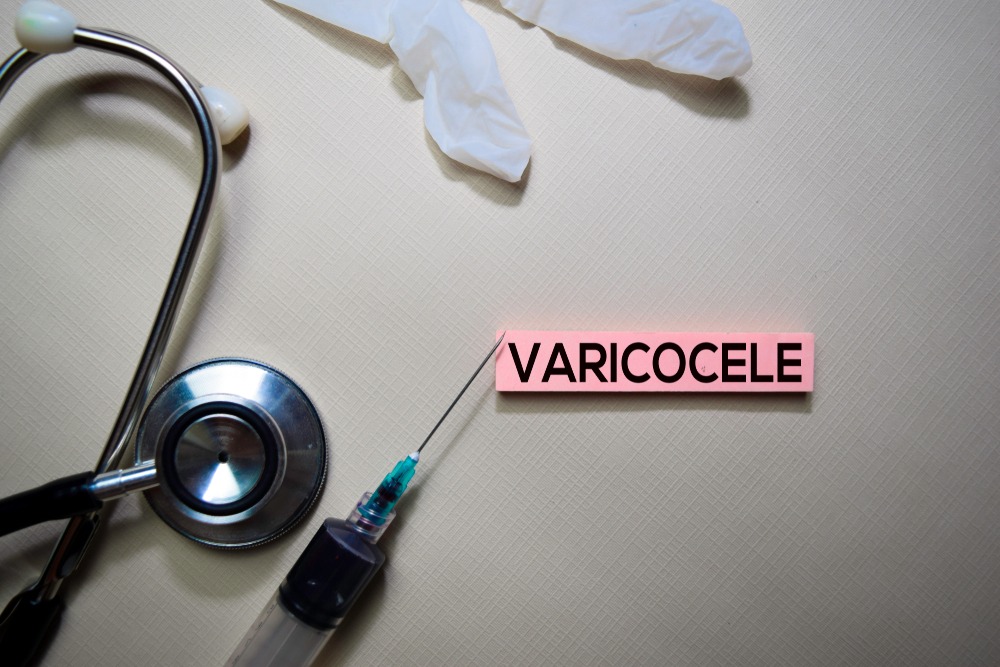 Varicocele: When the Veins Take a Wrong Turn!